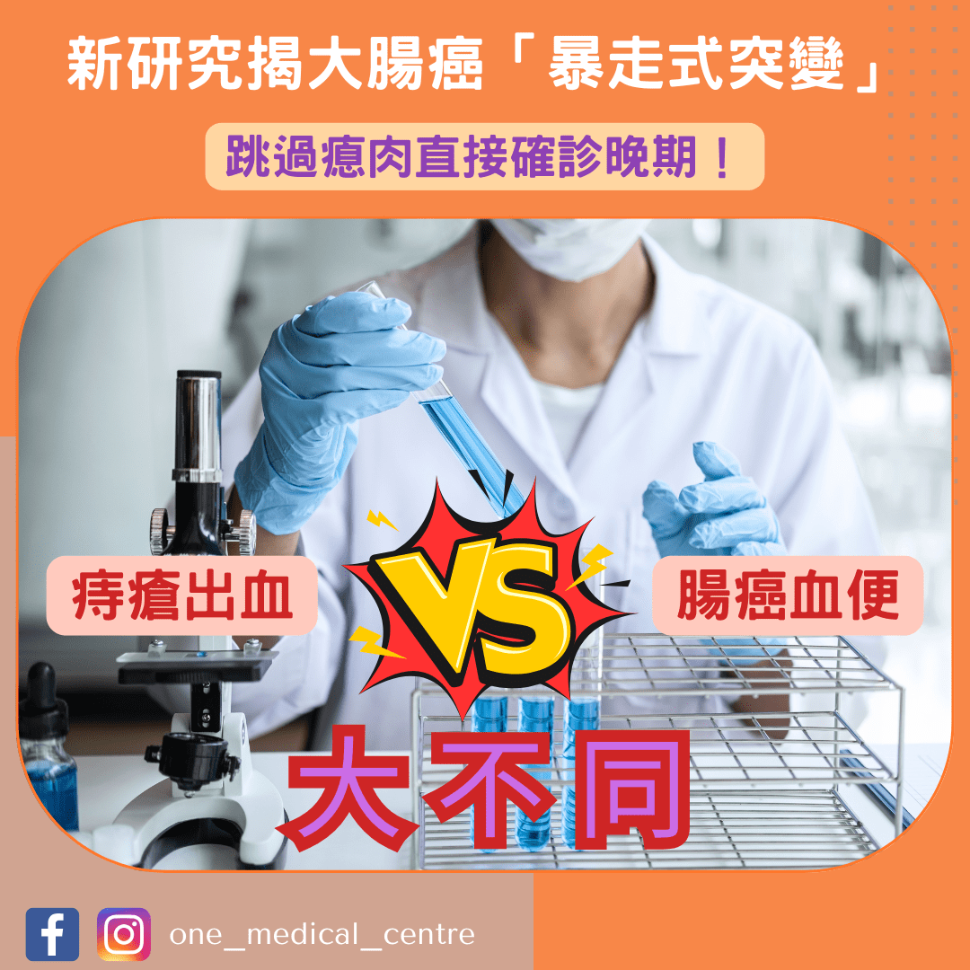 【新研究揭大腸癌「暴走式突變」　跳過瘜肉直接確診晚期　醫生示警3徵狀易被混淆】